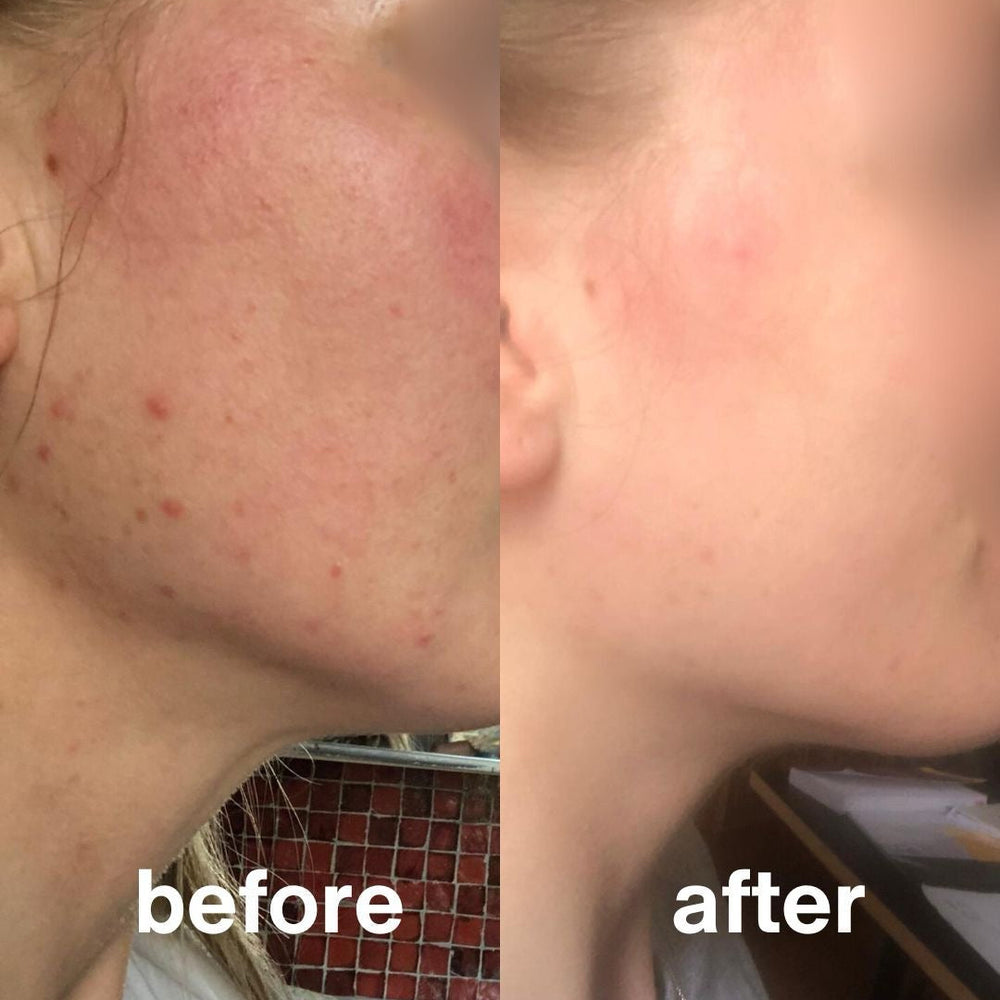 Skin Repair & Glow Bundle